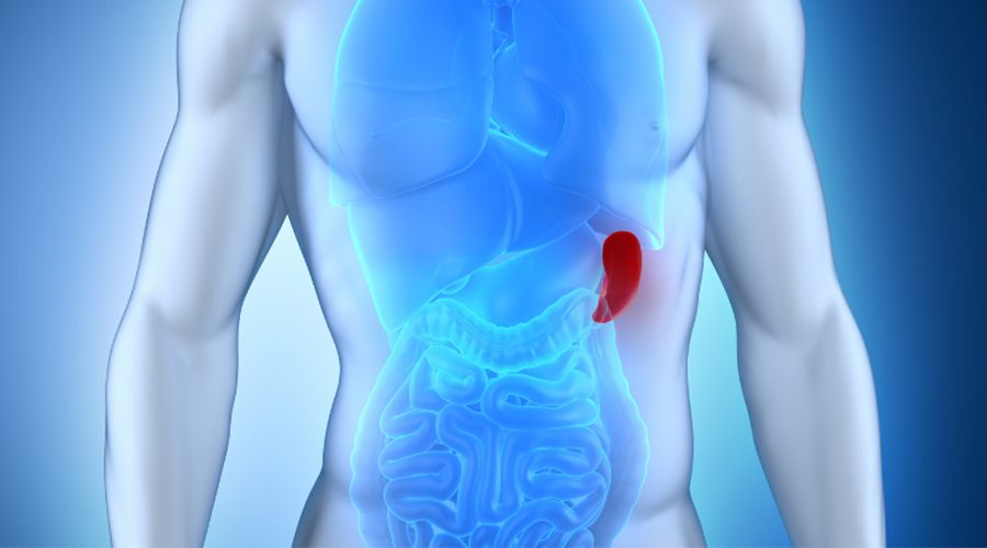 تضخّم الطحال