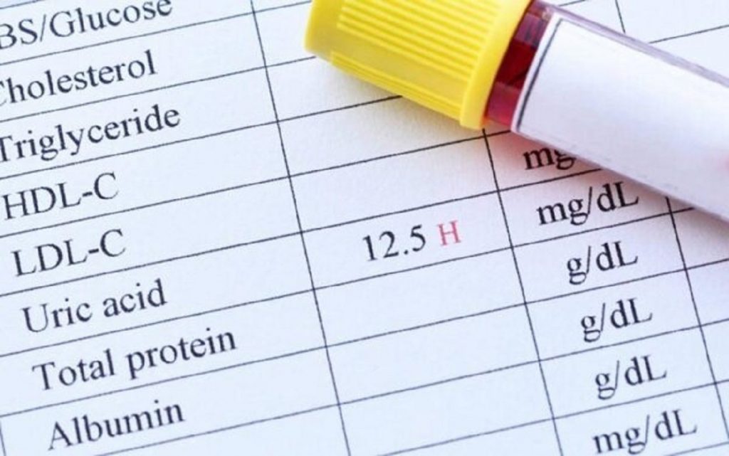 حمض اليوريك