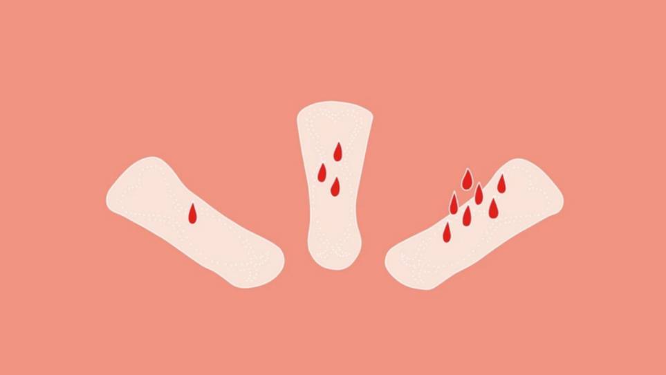 زيادة نزف الدورة