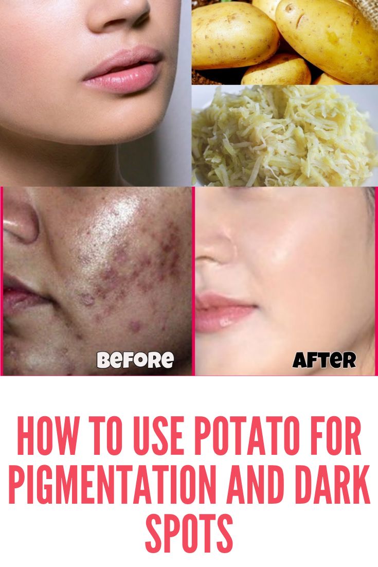 تفتيح بشرة الوجه