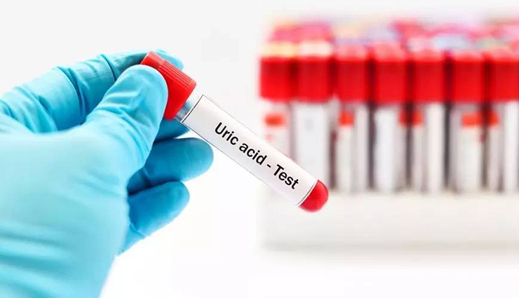 حمض اليوريك