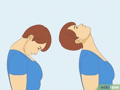 انقباض الرقبة