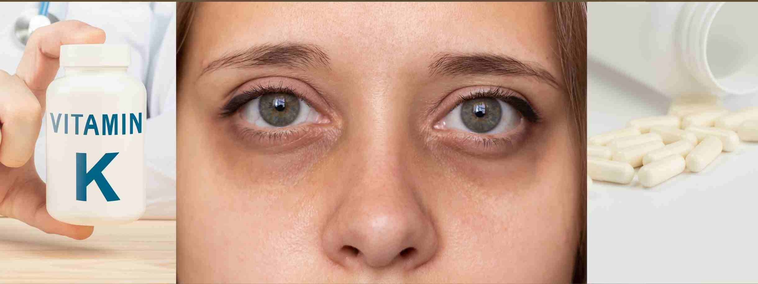 غؤور تحت العين