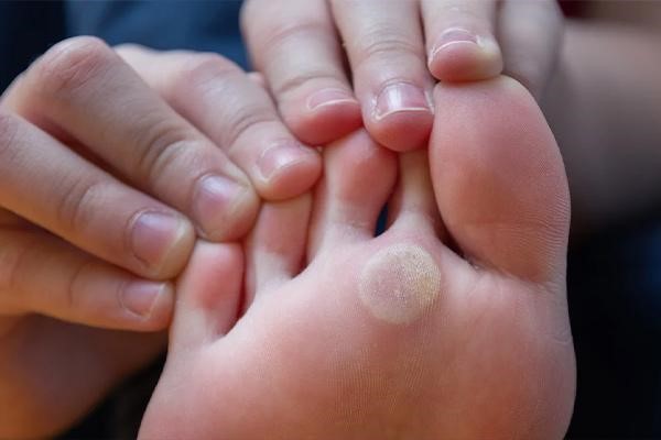 ما الذي يفيد مسمار القدم؟