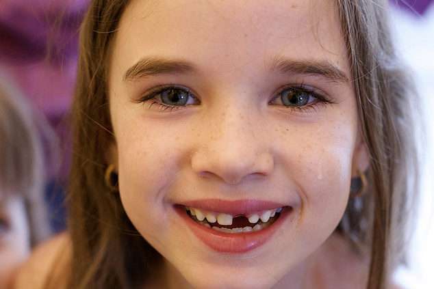 سقوط الأسنان